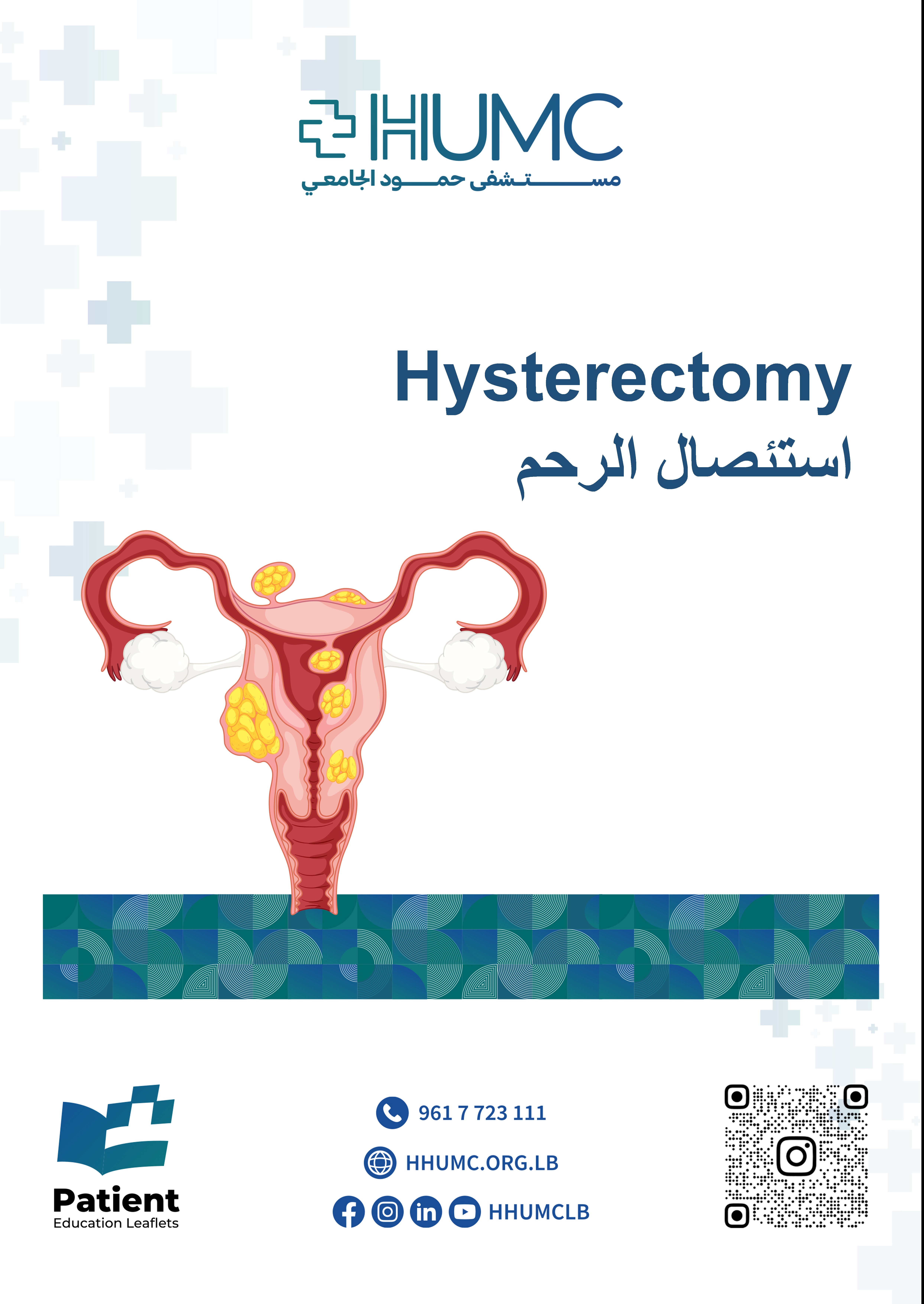 Hysterectomy