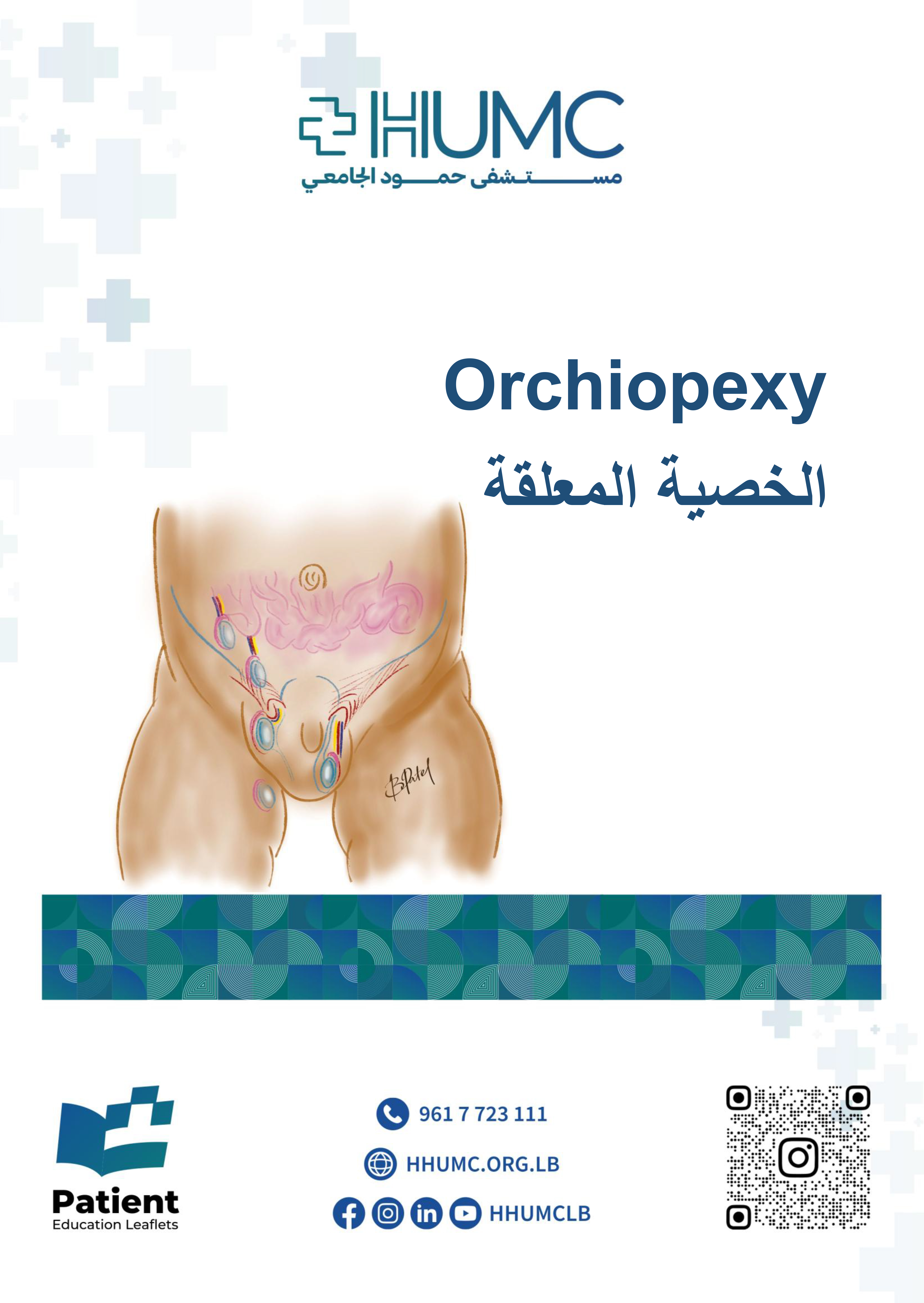Orchiopexy