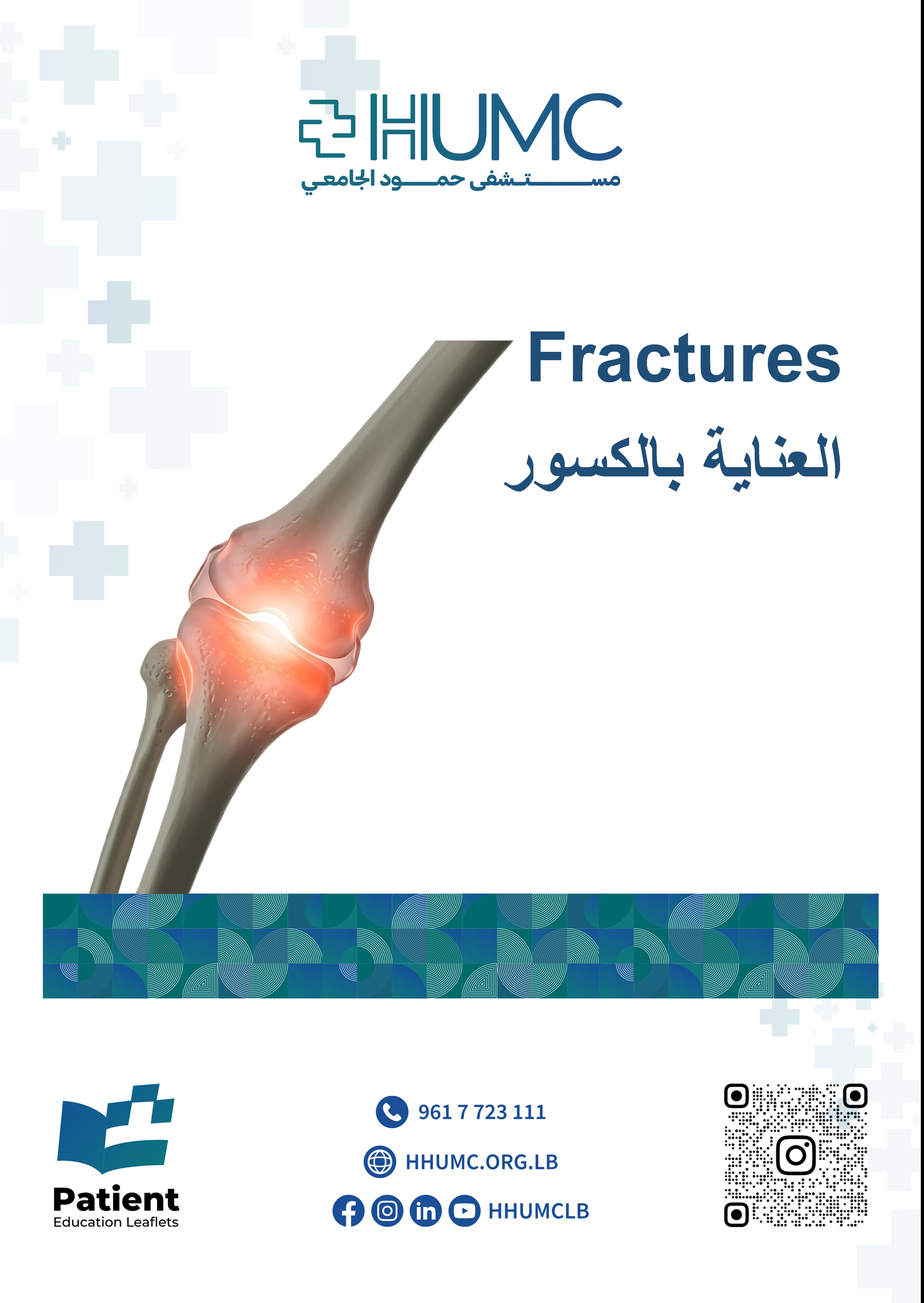 Fractures